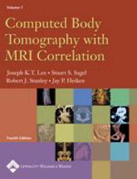 Computed Body Tomography with MRI Correlation pdf epub mobi 电子书 下载