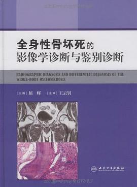 全身性骨坏死的影像学诊断与鉴别诊断 pdf epub mobi 电子书 下载