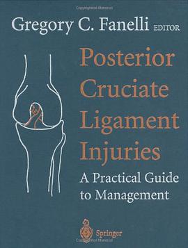 Posterior Cruciate Ligament Injuries pdf epub mobi 电子书 下载