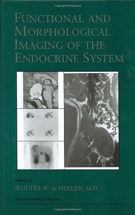 Functional and Morphological Imaging of the Endocrine System pdf epub mobi 电子书 下载