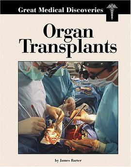 Organ Transplants pdf epub mobi 下载