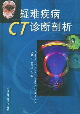 疑难疾病CT诊断剖析 pdf epub mobi 电子书 下载