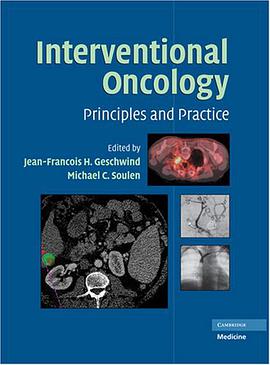 Interventional Oncology pdf epub mobi 电子书 下载