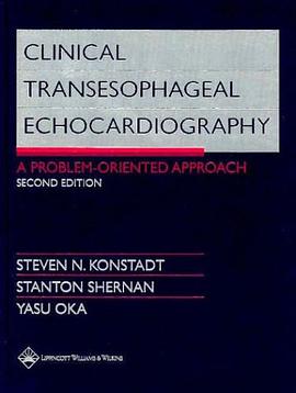 Clinical Transesophageal Echocardiography pdf epub mobi 电子书 下载