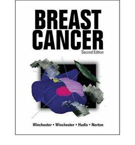 “BREAST CANCER ||2E 乳腺癌 pdf epub mobi 電子書 下載
