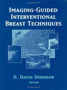 Imaging-guided Interventional Breast Techniques pdf epub mobi 电子书 下载