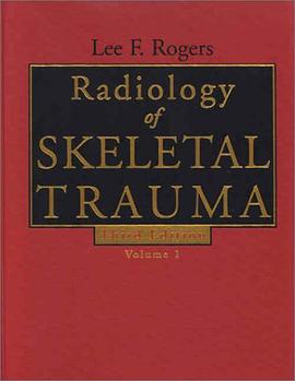 Radiology of Skeletal Trauma