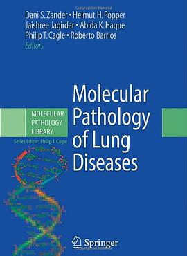 Molecular Pathology of Lung Diseases pdf epub mobi 电子书 下载