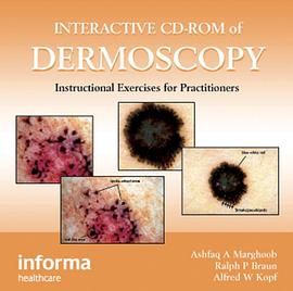 Interactive CD-ROM of Dermoscopy