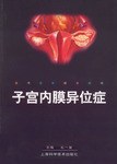 子宫内膜异位症 pdf epub mobi 下载