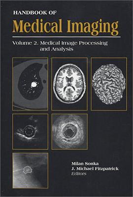 "Handbook of Medical Imaging, Volume 2. Medical Image Processing and Analysis (SPIE Press Monograph  pdf epub mobi 电子书 下载