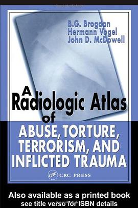 A Radiologic Atlas of Abuse, Torture, Terrorism and Inflicted Trauma pdf epub mobi 电子书 下载