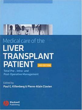 Medical Care of the Liver Transplant Patient pdf epub mobi 下载