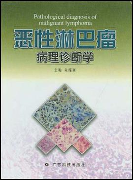 恶性淋巴瘤病理诊断学 pdf epub mobi 电子书 下载