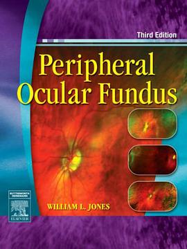 Peripheral Ocular Fundus pdf epub mobi 电子书 下载