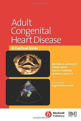 Adult Congenital Heart Disease pdf epub mobi 电子书 下载