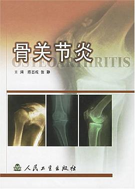 骨关节炎 pdf epub mobi 电子书 下载