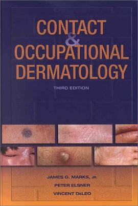 Contact and Occupational Dermatology pdf epub mobi 電子書 下載