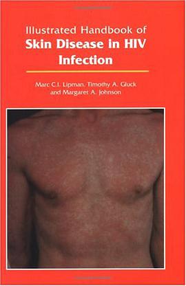 Illustrated Handbook of Skin Disease in HIV Infection pdf epub mobi 电子书 下载