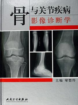骨与关节疾病影像诊断学 pdf epub mobi 电子书 下载