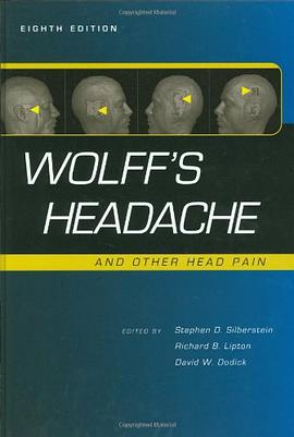 Wolff's Headache and Other Head Pain pdf epub mobi 电子书 下载