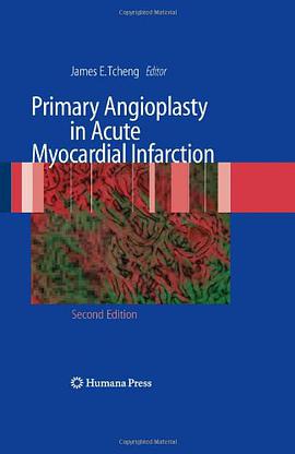 Primary Angioplasty in Acute Myocardial Infarction pdf epub mobi 电子书 下载