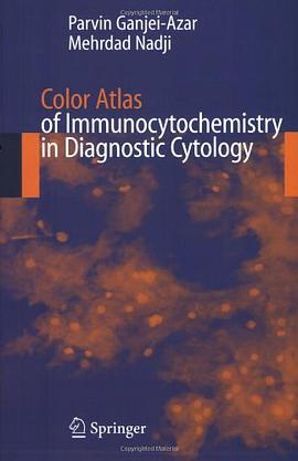 Color Atlas of Immunocytochemistry in Diagnostic Cytology pdf epub mobi 电子书 下载