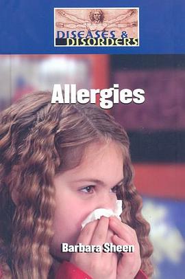 Allergies pdf epub mobi 电子书 下载