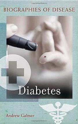 Diabetes pdf epub mobi 电子书 下载