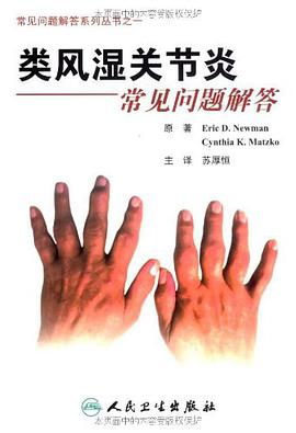 类风湿关节炎常见问题解答