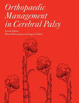 Orthopaedic Management in Cerebral Palsy