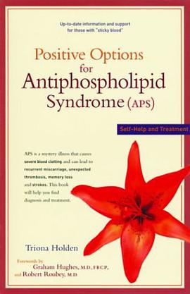 Postivie Options for Antiphospholipid Syndrome pdf epub mobi 电子书 下载