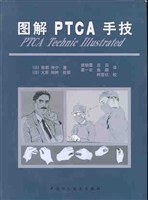 图解 PTCA 手技 pdf epub mobi 电子书 下载