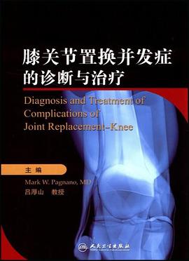 膝关节置换并发症的诊断与治疗 pdf epub mobi 电子书 下载