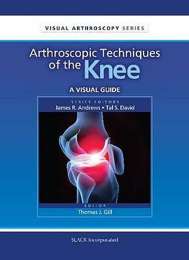 Arthroscopic Techniques of the Knee pdf epub mobi 电子书 下载