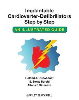 Implantable Cardioverter - Defibrillators Step by Step pdf epub mobi 電子書 下載