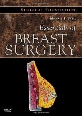Essentials of Breast Surgery pdf epub mobi 电子书 下载