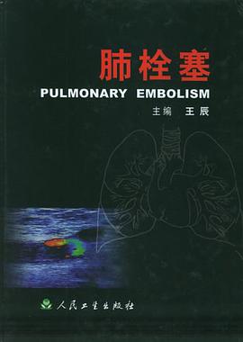 肺栓塞 pdf epub mobi 電子書 下載