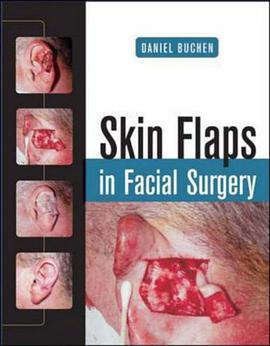 Skin Flaps in Facial Surgery pdf epub mobi 电子书 下载