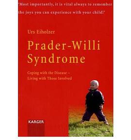 Prader-willi Syndrome pdf epub mobi 电子书 下载