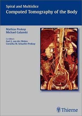 和多层螺旋计算机断层摄影术的机构 Spiral and Multislice Computed Tomography of the Body pdf epub mobi 电子书 下载