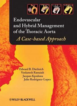 Endovascular and Hybrid Management of the Thoracic Aorta pdf epub mobi 电子书 下载