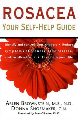 Rosacea pdf epub mobi 下载