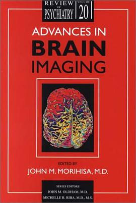 Advances in Brain Imaging pdf epub mobi 电子书 下载