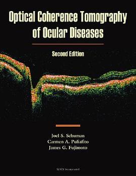 Optical Coherence Tomography of Ocular Diseases pdf epub mobi 電子書 下載