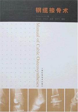 钢缆接骨术 pdf epub mobi 电子书 下载