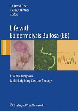 Life with Epidermolysis Bullosa pdf epub mobi 电子书 下载