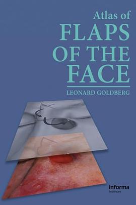 An Atlas of Flaps of the Face