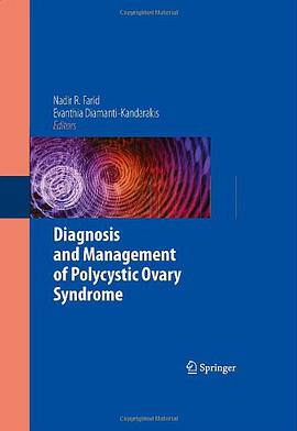Diagnosis and Management of Polycystic Ovary Syndrome pdf epub mobi 电子书 下载