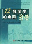 12导同步心电图图谱 pdf epub mobi 电子书 下载